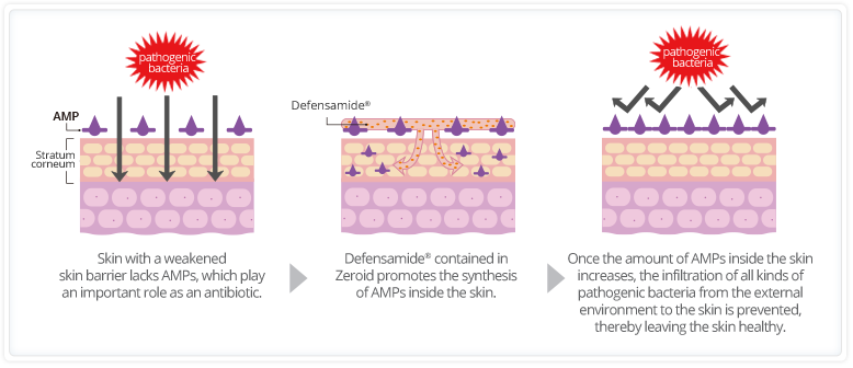 step1:Skin with a weakened skin barrier lacks AMPs, which play an important role as an antibiotic./step2:Defensamide<sup>®</sup> contained in Zeroid promotes the synthesis of AMPs inside the skin./step3:Once the amount of AMPs inside the skin increases, the infiltration of all kinds of pathogenic bacteria from the external environment to the skin is prevented, thereby leaving the skin healthy.